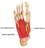 Mp Joint Foot